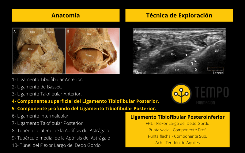 Ligamento Tibiofibular Posterioinferior.png